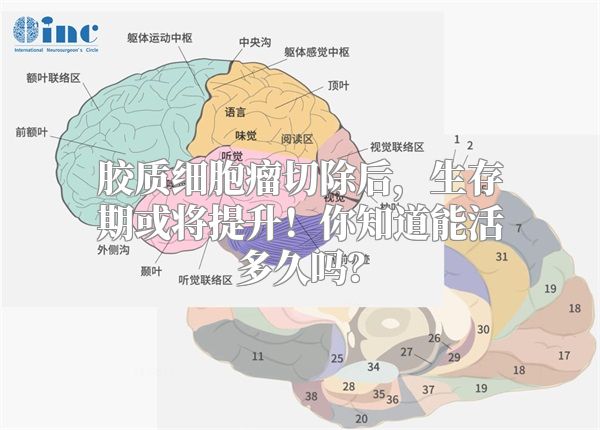 胶质细胞瘤切除后，生存期或将提升！你知道能活多久吗？