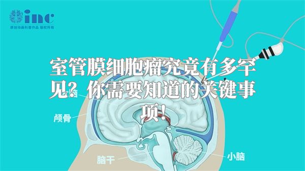 室管膜细胞瘤究竟有多罕见？你需要知道的关键事项！