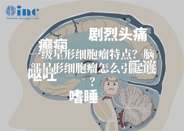 一级星形细胞瘤特点？脑部星形细胞瘤怎么引起的？