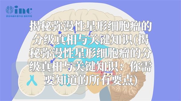 揭秘弥漫性星形细胞瘤的分级真相与关键知识(揭秘弥漫性星形细胞瘤的分级真相与关键知识：你需要知道的所有要点)
