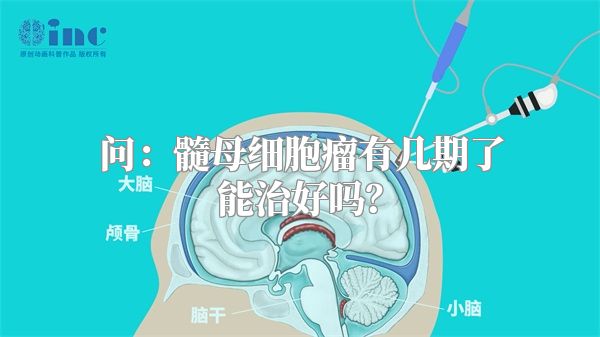 问：髓母细胞瘤有几期了能治好吗？