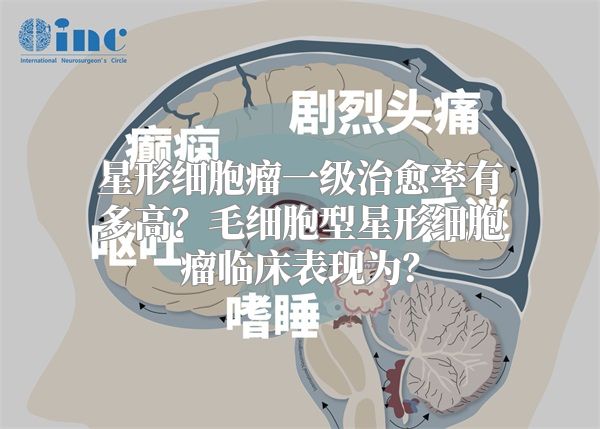 星形细胞瘤一级治愈率有多高？毛细胞型星形细胞瘤临床表现为？