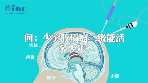 问：少突胶质瘤二级能活多少年？