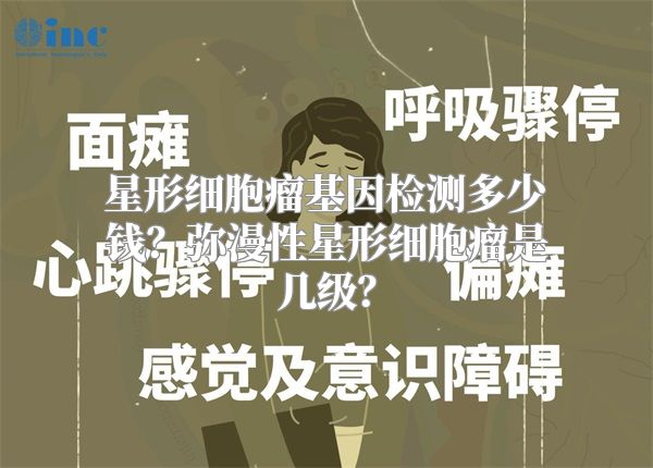 星形细胞瘤基因检测多少钱？弥漫性星形细胞瘤是几级？