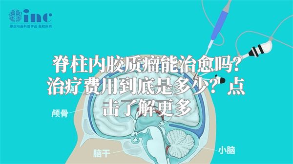 脊柱内胶质瘤能治愈吗？治疗费用到底是多少？点击了解更多