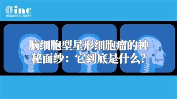 脑细胞型星形细胞瘤的神秘面纱：它到底是什么？