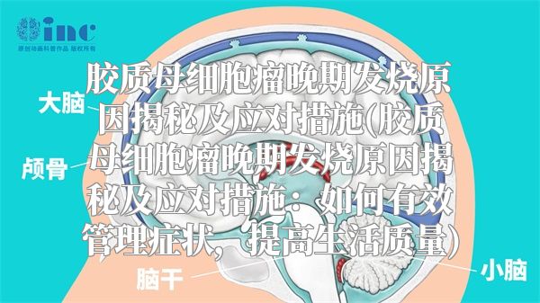 胶质母细胞瘤晚期发烧原因揭秘及应对措施(胶质母细胞瘤晚期发烧原因揭秘及应对措施：如何有效管理症状，提高生活质量)