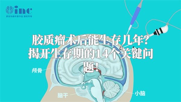 胶质瘤术后能生存几年？揭开生存期的14个关键问题！