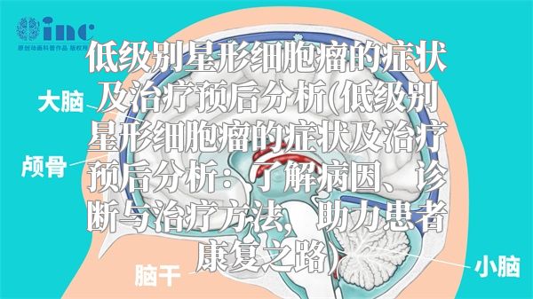 低级别星形细胞瘤的症状及治疗预后分析(低级别星形细胞瘤的症状及治疗预后分析：了解病因、诊断与治疗方法，助力患者康复之路)