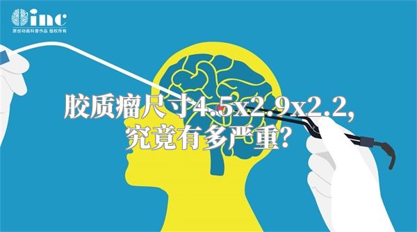 胶质瘤尺寸4.5x2.9x2.2，究竟有多严重？