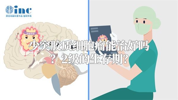 少突胶质细胞瘤能治好吗？2级的生存期？
