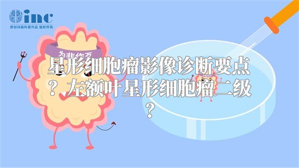 星形细胞瘤影像诊断要点？左额叶星形细胞瘤二级？