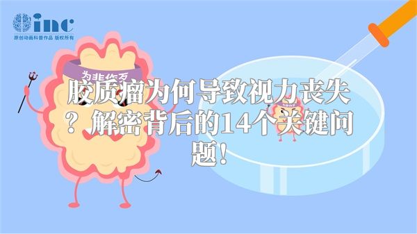 胶质瘤为何导致视力丧失？解密背后的14个关键问题！