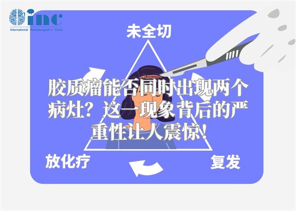 胶质瘤能否同时出现两个病灶？这一现象背后的严重性让人震惊！