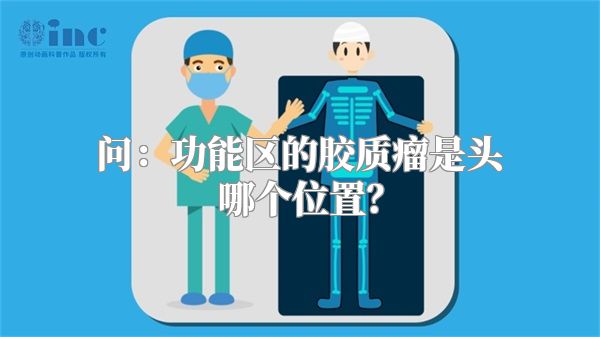 问：功能区的胶质瘤是头哪个位置？