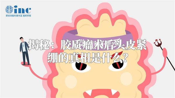揭秘：胶质瘤术后头皮紧绷的真相是什么？
