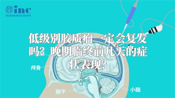 低级别胶质瘤一定会复发吗？晚期临终前几天的症状表现？