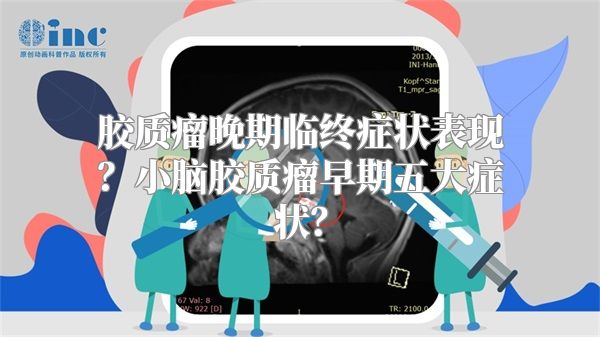 胶质瘤晚期临终症状表现？小脑胶质瘤早期五大症状？