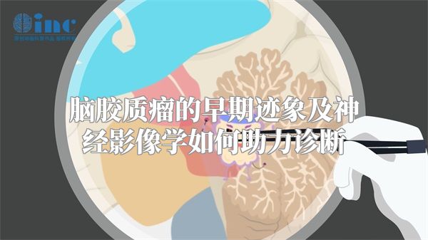 脑胶质瘤的早期迹象及神经影像学如何助力诊断