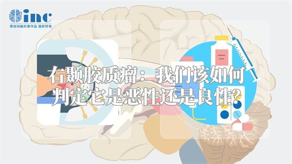 右颞胶质瘤：我们该如何判定它是恶性还是良性？