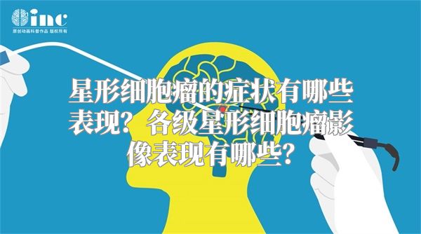 星形细胞瘤的症状有哪些表现？各级星形细胞瘤影像表现有哪些？
