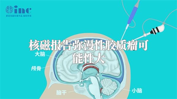 核磁报告弥漫性胶质瘤可能性大
