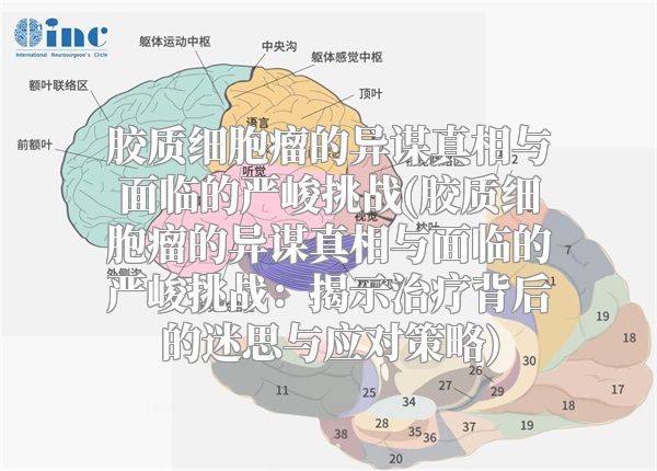 胶质细胞瘤的异谋真相与面临的严峻挑战(胶质细胞瘤的异谋真相与面临的严峻挑战：揭示治疗背后的迷思与应对策略)
