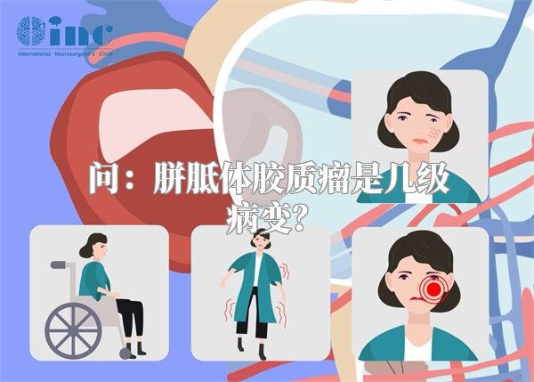 问：胼胝体胶质瘤是几级病变？