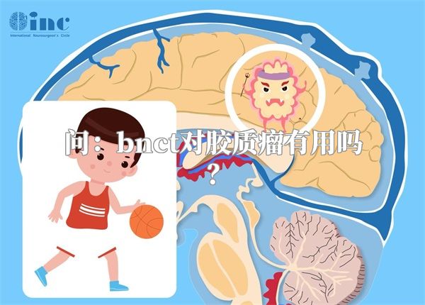 问：bnct对胶质瘤有用吗？