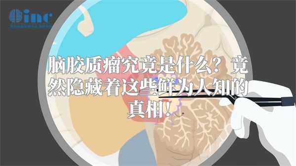 脑胶质瘤究竟是什么？竟然隐藏着这些鲜为人知的真相！
