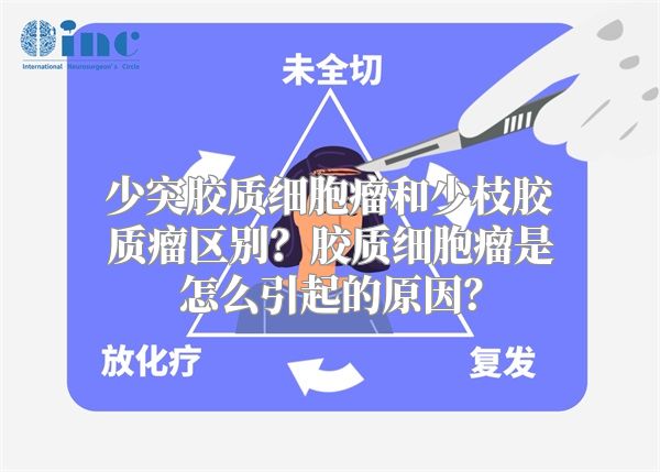 少突胶质细胞瘤和少枝胶质瘤区别？胶质细胞瘤是怎么引起的原因？