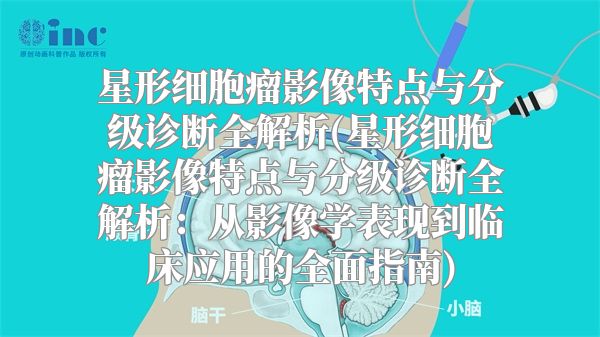 星形细胞瘤影像特点与分级诊断全解析(星形细胞瘤影像特点与分级诊断全解析：从影像学表现到临床应用的全面指南)