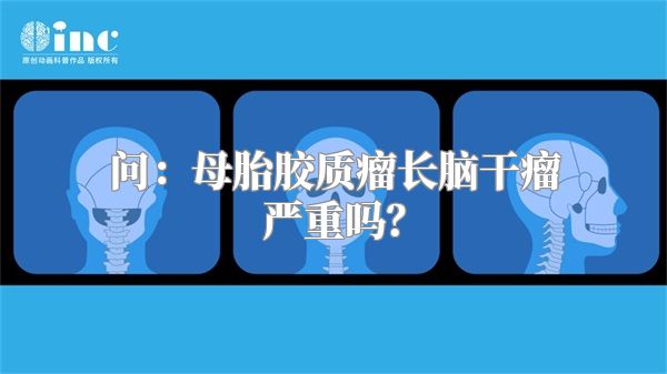 问：母胎胶质瘤长脑干瘤严重吗？