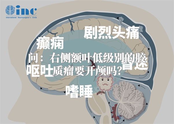 问：右侧额叶低级别的胶质瘤要开颅吗？