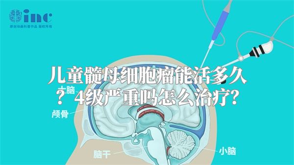 儿童髓母细胞瘤能活多久？4级严重吗怎么治疗？