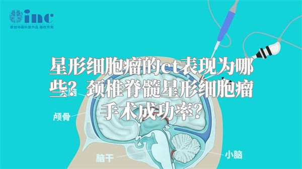 星形细胞瘤的ct表现为哪些？颈椎脊髓星形细胞瘤手术成功率？