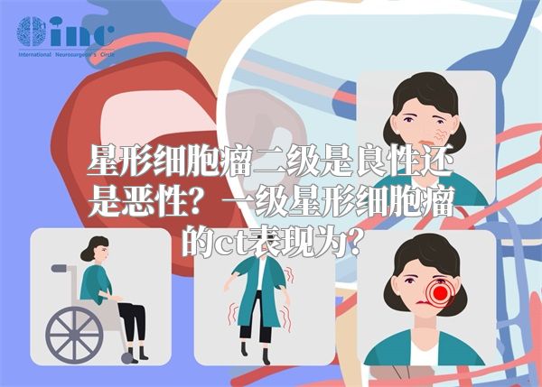 星形细胞瘤二级是良性还是恶性？一级星形细胞瘤的ct表现为？