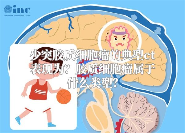 少突胶质细胞瘤的典型ct表现为？胶质细胞瘤属于什么类型？