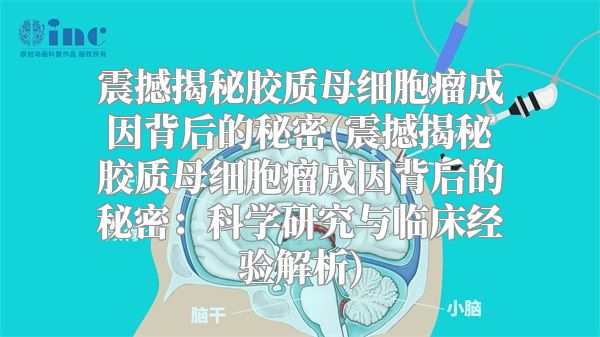 震撼揭秘胶质母细胞瘤成因背后的秘密(震撼揭秘胶质母细胞瘤成因背后的秘密：科学研究与临床经验解析)