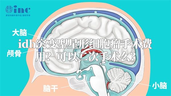 idh突变型星形细胞瘤手术费用？可以二次手术么？