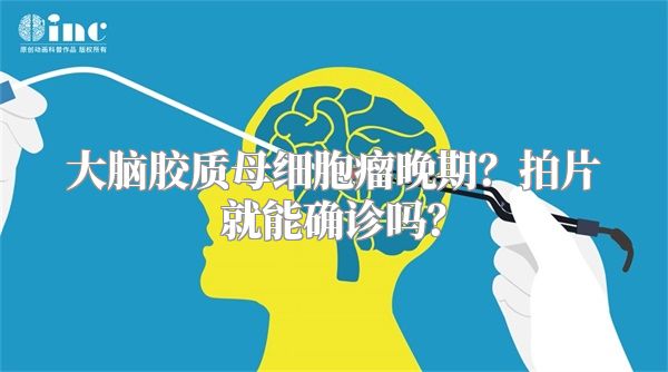 大脑胶质母细胞瘤晚期？拍片就能确诊吗？