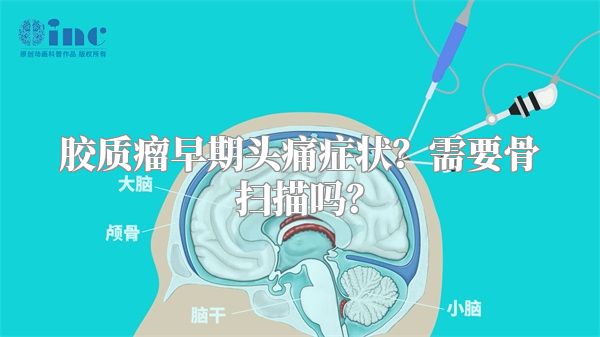 胶质瘤早期头痛症状？需要骨扫描吗？