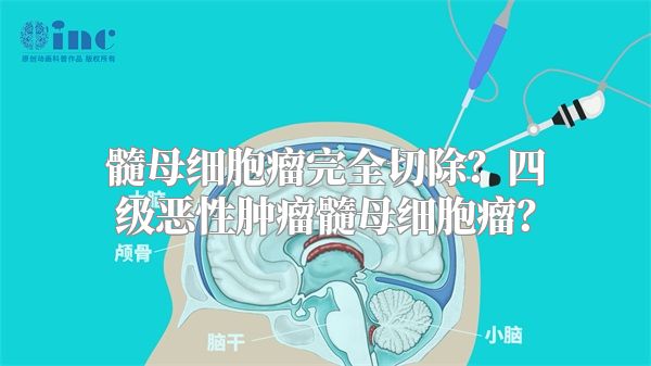 髓母细胞瘤完全切除？四级恶性肿瘤髓母细胞瘤？