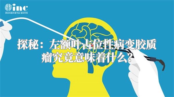 探秘：左额叶占位性病变胶质瘤究竟意味着什么？