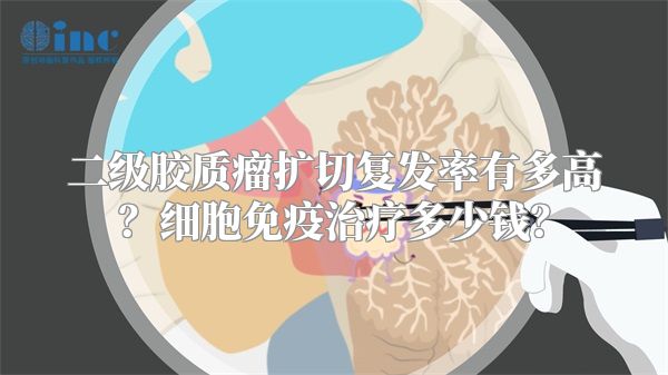 二级胶质瘤扩切复发率有多高？细胞免疫治疗多少钱？
