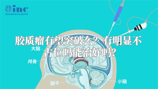 胶质瘤有望突破么？有明显不占位吗能治好吗？