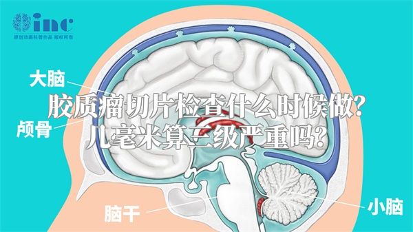 胶质瘤切片检查什么时候做？几毫米算三级严重吗？