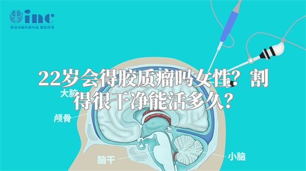 22岁会得胶质瘤吗女性？割得很干净能活多久？