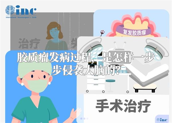 胶质瘤发病过程，是怎样一步步侵袭大脑的？
