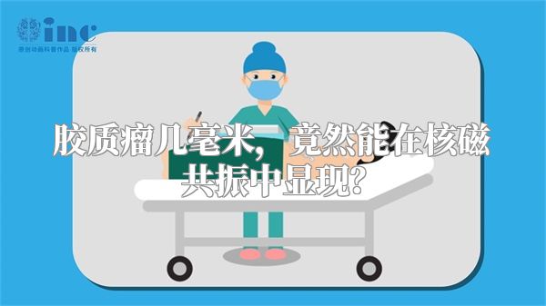 胶质瘤几毫米，竟然能在核磁共振中显现？